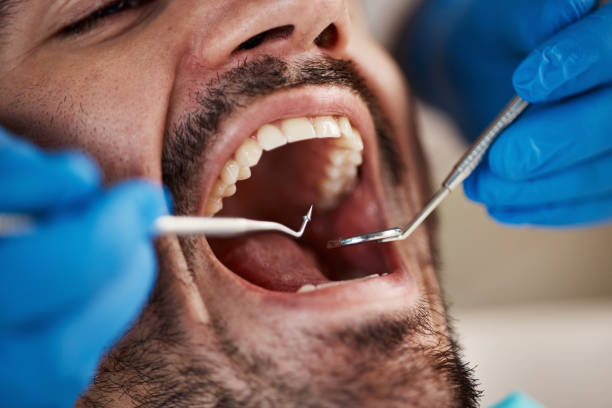 Best Same-Day Dentist Appointment  in Ellinwood, KS